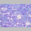 Pancreas SF 07.jpg